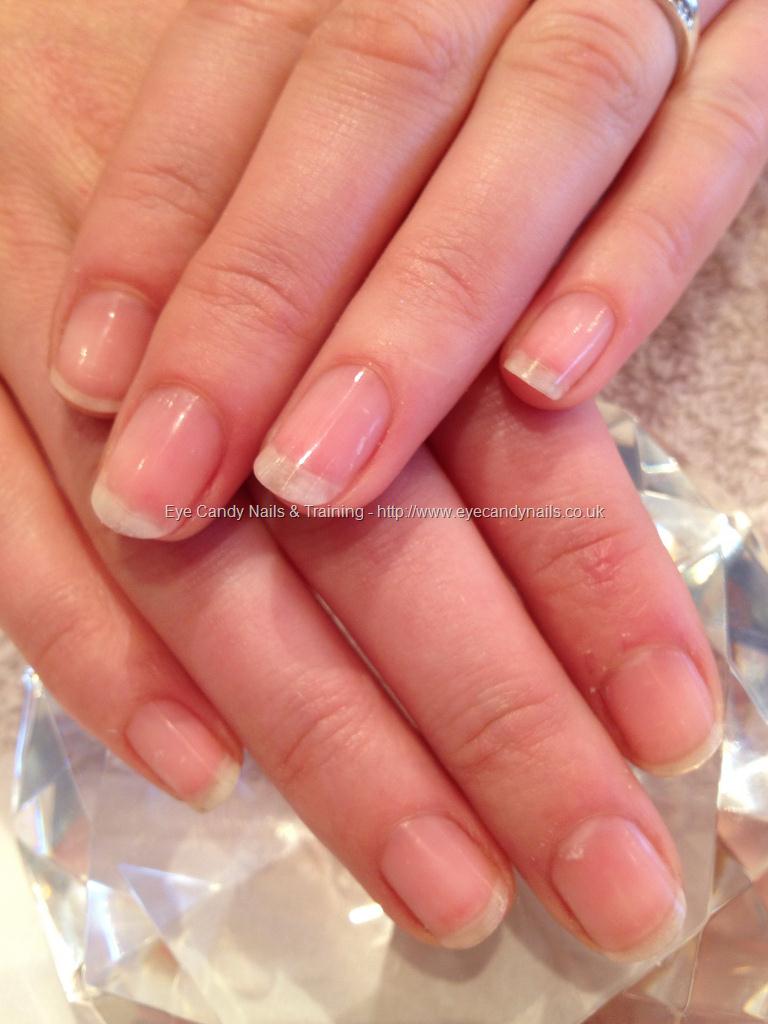 Eye Candy Nails & Training - Natural nails after acrylic removal by Elaine  Moore on 25 August 2012 at 03:42
