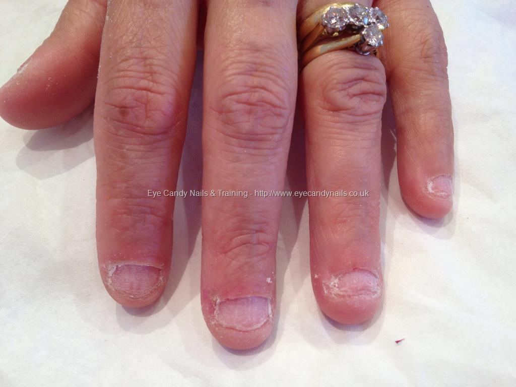 Eye Candy Nails & Training - Badly bitten nails before ...